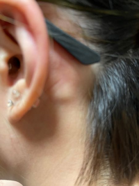 何科に行けば良いか迷っています 三日前から耳の後ろが痛く 触ると腫れている Yahoo 知恵袋