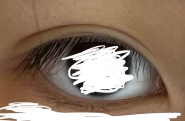 この瞼って変ですか？ 奥二重の線が消えなくてハム目みたいになってしまいます。線を消すにはどうすればいいですか？