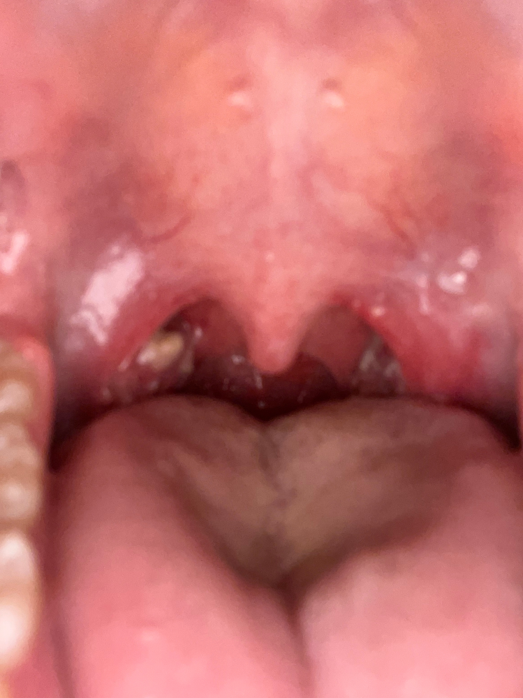 1週間前から風俗の仕事を始めたのですが 3 1日前から喉の痛みがありますこ Yahoo 知恵袋