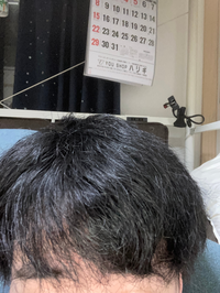 メンズパーマあてたいんですが 癖毛で毛量が本当に多く かなり太 Yahoo 知恵袋