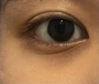 日焼け止めのみ塗っている状態です クマに悩んでいます ずっと消え Yahoo 知恵袋