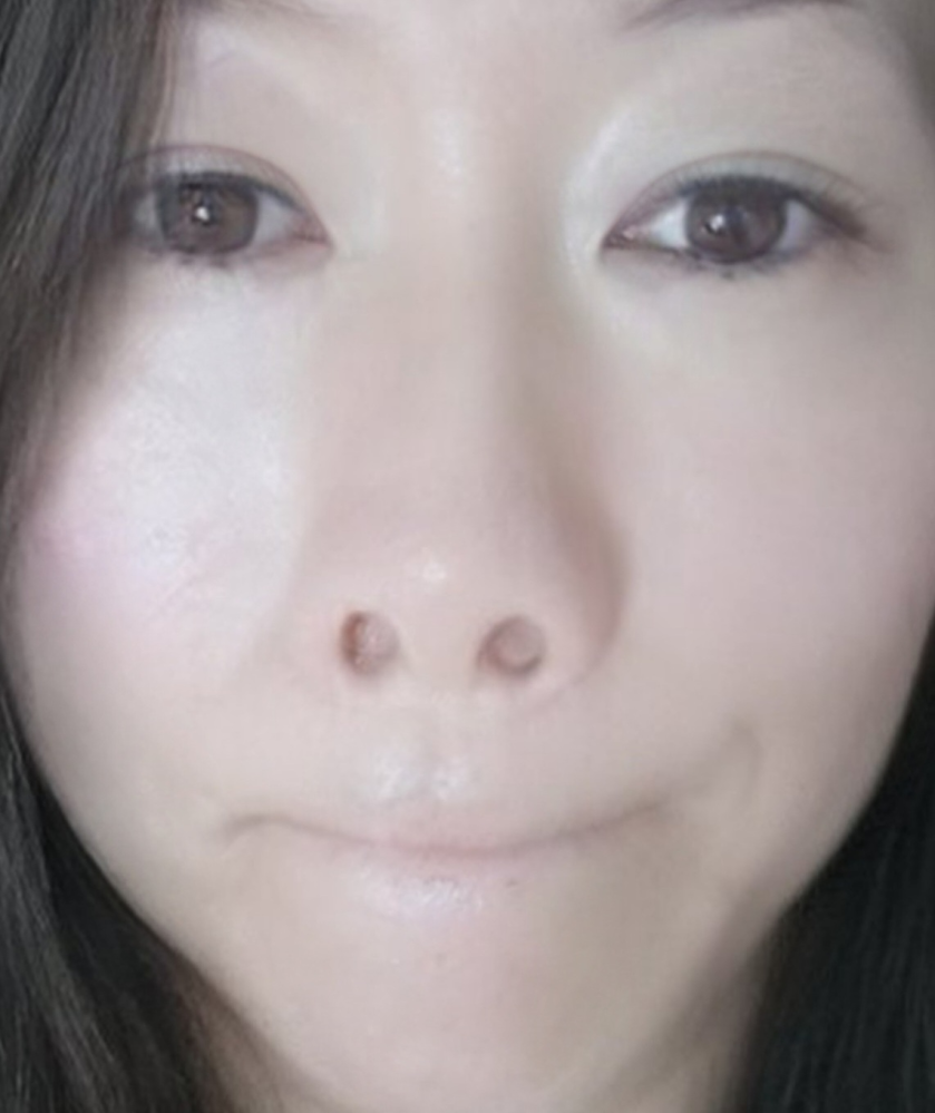 鼻 の 下 伸ばす と 臭い 知恵袋