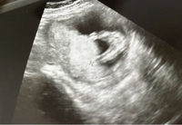 16週前のエコー写真赤ちゃん性別先日妊婦健診にてこの写真を貰った Yahoo 知恵袋