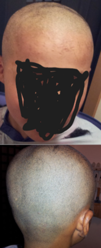 添付した画像のように初めて丸坊主にしてみました この坊主について Yahoo 知恵袋