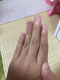 昔爪をむしる癖があり 今は爪の白い部分の面積がとても広くなってしまっています Yahoo 知恵袋
