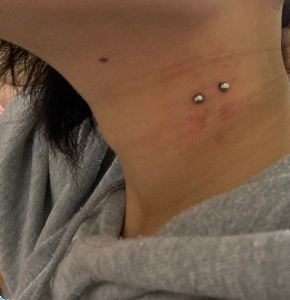 先程 ヴァンパイアピアスをあけたのですがこれホール 埋まってます Yahoo 知恵袋