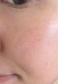 ファンデーションのヨレについて。お昼頃にはこのような状態です。改  