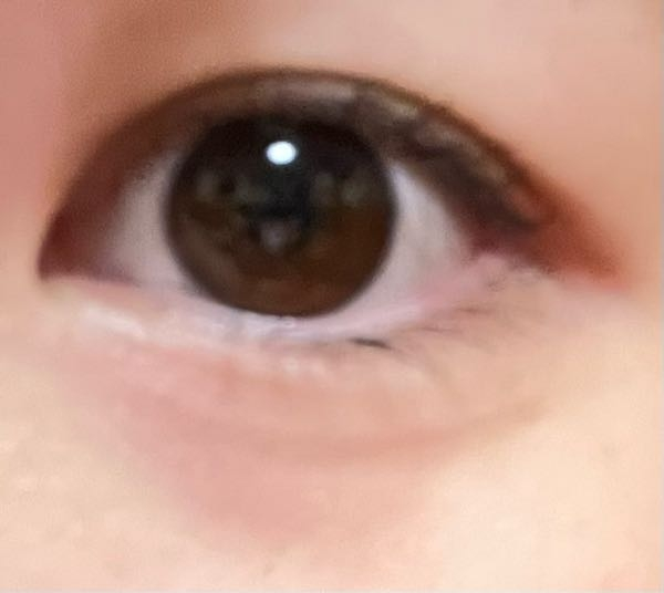 私は元から二重なのですが二重の幅を広げたいんです、それで質問なの