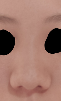 この画像はノーズシャドウした後の鼻です ノーズシャドウしたのにし Yahoo 知恵袋