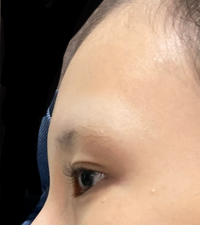 絶壁のおでこだったら前髪のばしてわける髪型は似合わないですか 似合 Yahoo 知恵袋