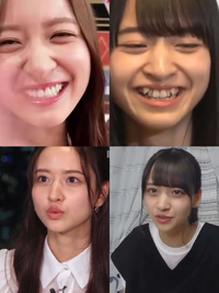 乃木坂46の金川紗耶さんの鼻は何整形ですか？ 