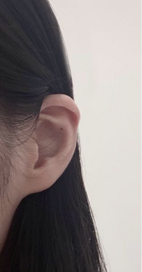 ピアス開けたいのですが私の耳形がおかしくてどこに開けたら可愛いのかわかりま Yahoo 知恵袋