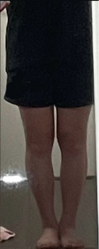 足太いですよね(；＿；)
どこが痩せたらもっとよく見えるでしょうか。 