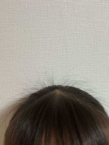 このアホ毛の量はやばいですかね、 アホ毛というかきれ毛です。 写真より現実の方がやばいんですよね、どうしたら切れ毛をなくせますか？