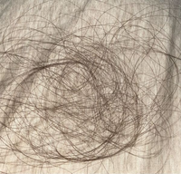 助けてください。最近髪の毛の抜ける量が異常です。抜ける量が多いとか  