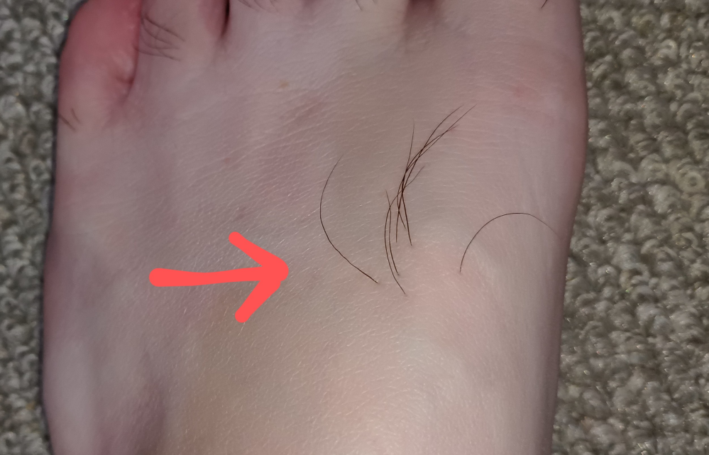 足のこの部分から毛が生えてるのですが、これは何のために生えてるのですが？ 子供の頃から生えてた気がします