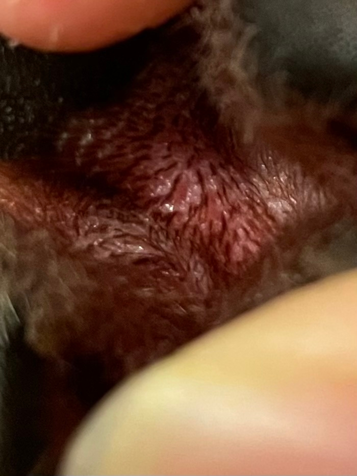 柴犬の左後ろ足の裏の皮膚が黒くて痒がっているので何か炎症を起こしていないか教えてください。 1年前程から足の裏の毛だけ黒くなってそこで病院で貰った塗り薬を塗って直したのですがまた炎症を起こしてしまいました。今回は左後ろ足だけで裏の指と指の間の毛が同じようになっています。また、犬が痒いのかずっと舐めているので足の毛が抜けています。舐めすぎて血が出てきてしまいました。今は舐めれないように首にエリザベスカラーをつけています。また、1年ほど前に炎症を起こした時に病院に行ったのですが犬が嫌がってあまり診察できずに塗り薬だけもらいました。炎症の名前がわかる方いたら教えて欲しいです。