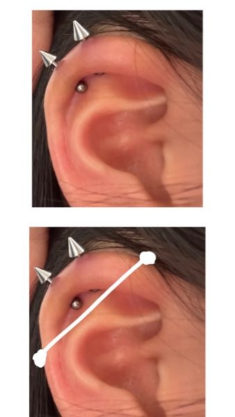 ⚠️耳の写真有ります。⚠️ ピアスについてです。 今私は左耳にアンテナを2個開けてます。次腫れがおさまってきて暫く経ってからインダストリアルを開けようと思っているのですが私の耳は巻があまりなくて排除されそうな気がします。 排除される可能性はありますか？ されないようなピアッシングできそうな耳ですかねT_T ずっとアンテナとインダスが開いている耳に憧れてて開けたいんですけど辞めた方がいいですか？ まだアンテナの腫れがあるのでパンパンですが、見ていただきたいです。