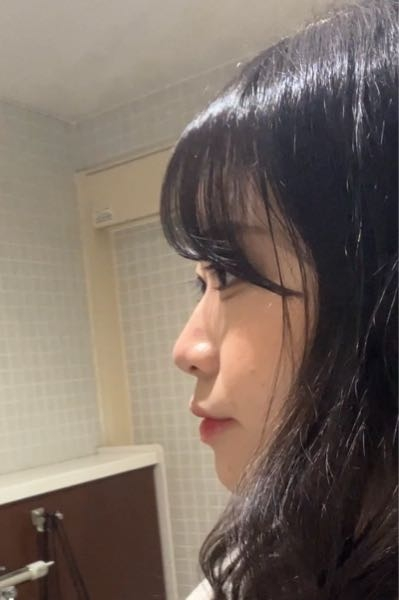 美容整形について これは口ゴボですか？ あと鼻根が低く頬の肉もついています どのような整形が最適ですかね