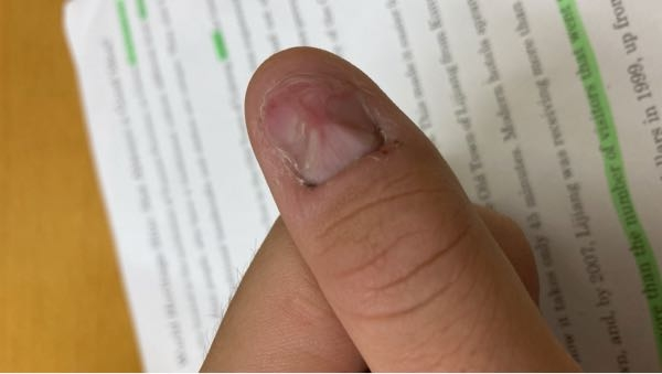 色々あって爪が変な形になったので、やすり続けてたら、すごいことになりました。 この爪めちゃめちゃ薄いです。見た通りベッコベコです。 爪サロンとかで治るもんですかね？