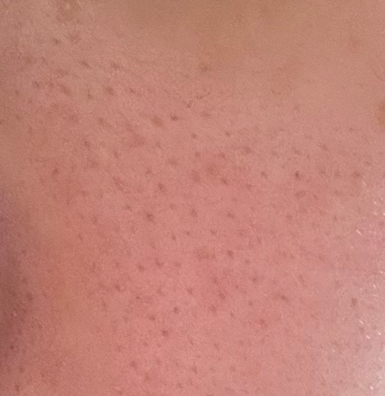 この肌はどうやったら綺麗になりますか？ できれば皮膚科などには行かずに治したいです。