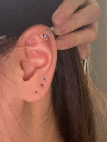 あまりいないと思いますが、「左2右2」「左2右4」「左4右2」など