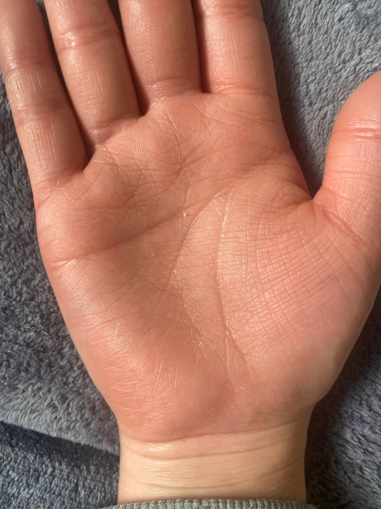 手相を見てほしいです。ますかけ線かなと思ってるけど違いますか
