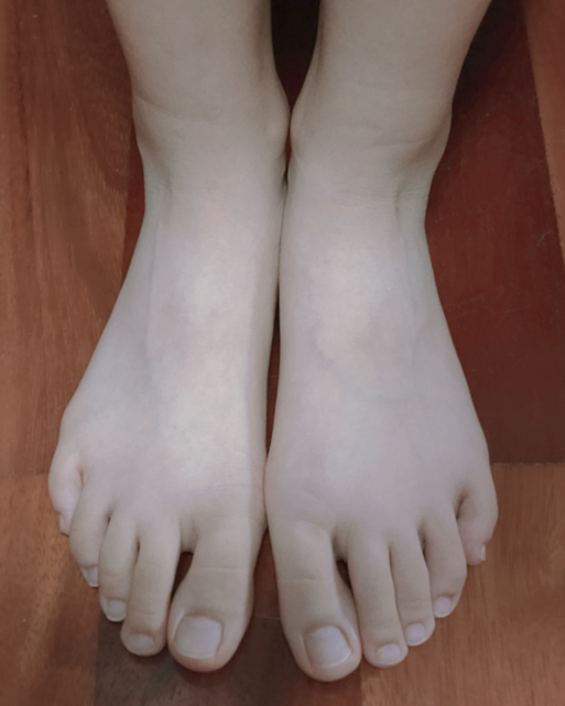 足が大きいくて悩んでいます。高2女子です。友達から「足大きいよね 