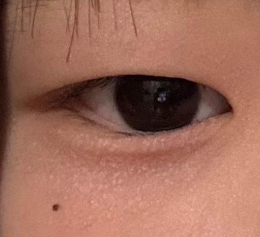 この目におすすめのアイプチの仕方を教えて欲しいです。汚い目ですみません。