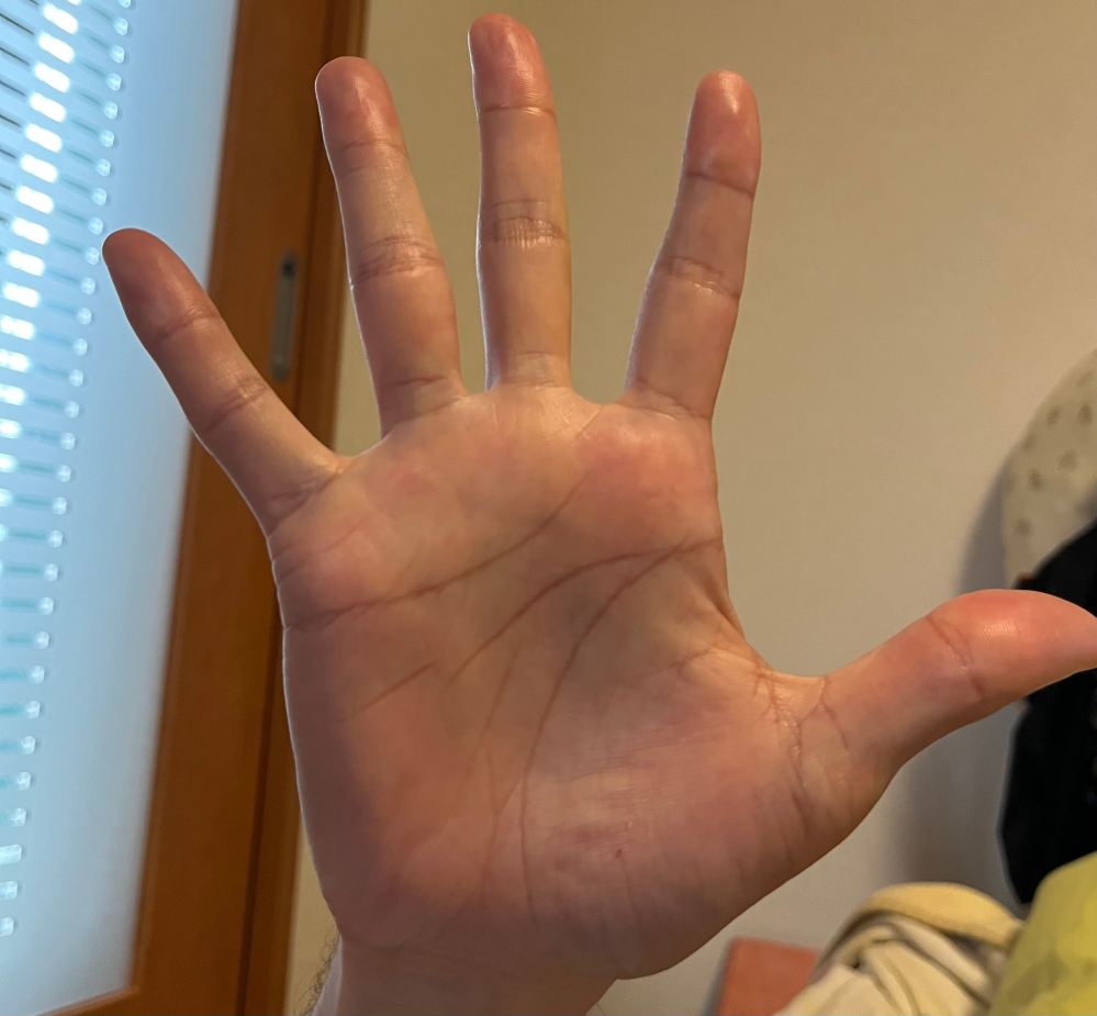 手相について 36歳 男 こちらの手相について、わかることを教えていただきたいです。よろしくお願いいたします。