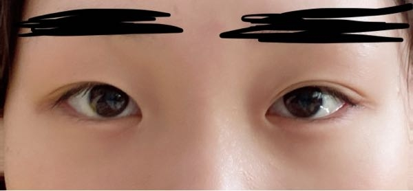 至急 どちらの二重の方が似合っていると思いますか...？ いつもは末広二重で幅狭めなのですが、平行二重だとメイクしないと変かなーと感じます。
