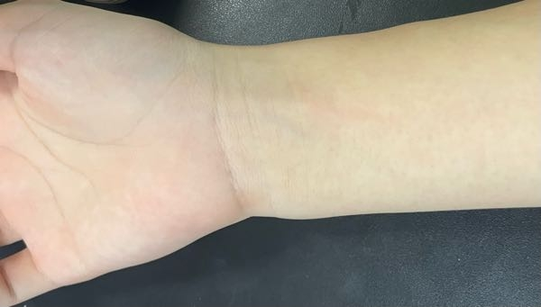 【至急】 この手はブルベですか？イエベですか？グリべですか？この3択だけで回答お願いします！