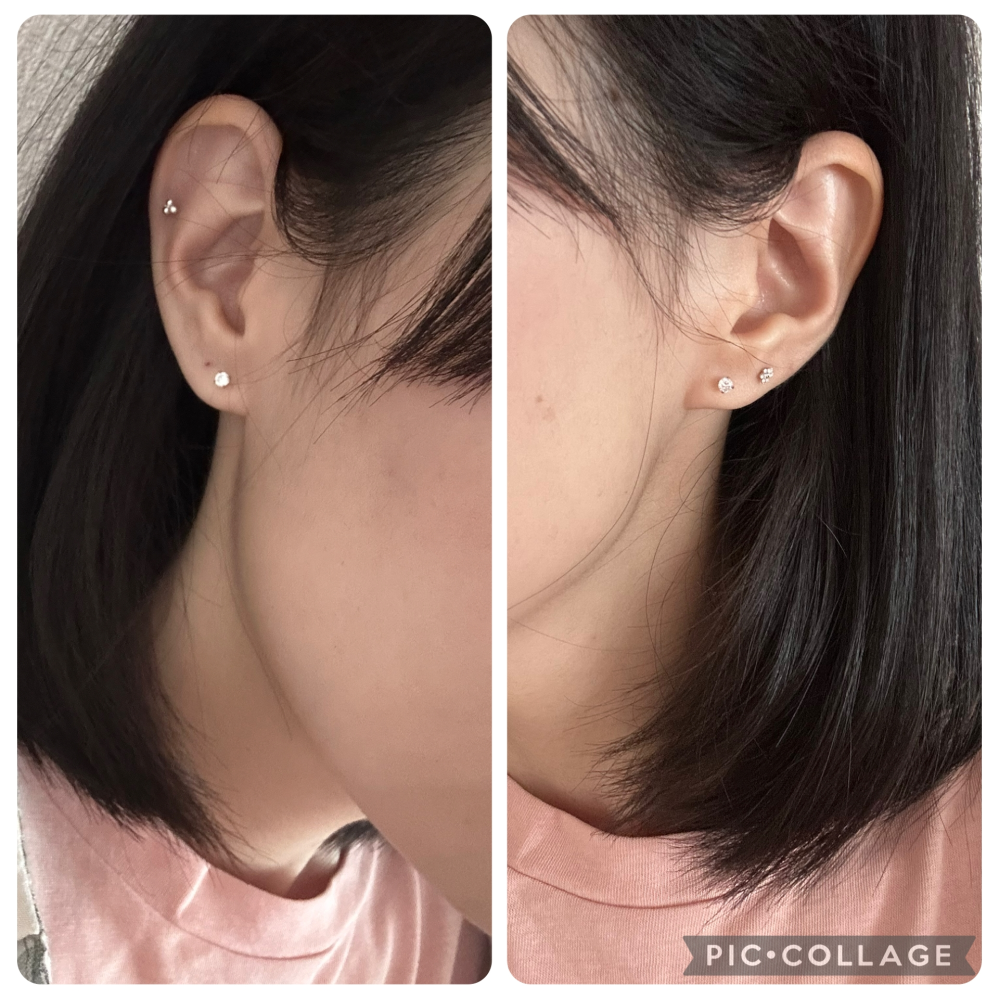 現在右ロブ1、ヘリックス1、左ロブ2空いています。（右にもう一つロブ