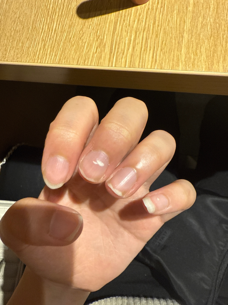 緊急です！！この爪に長さだしネイルできますか？折れてしまいました