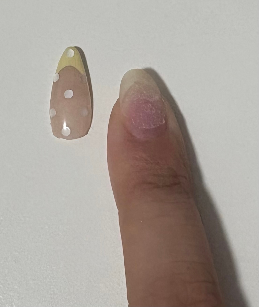 認定モデルハンド 両手 「右手の人差し指骨折」 ▽STモデルハンド 両手セット / NESオンラインショップ