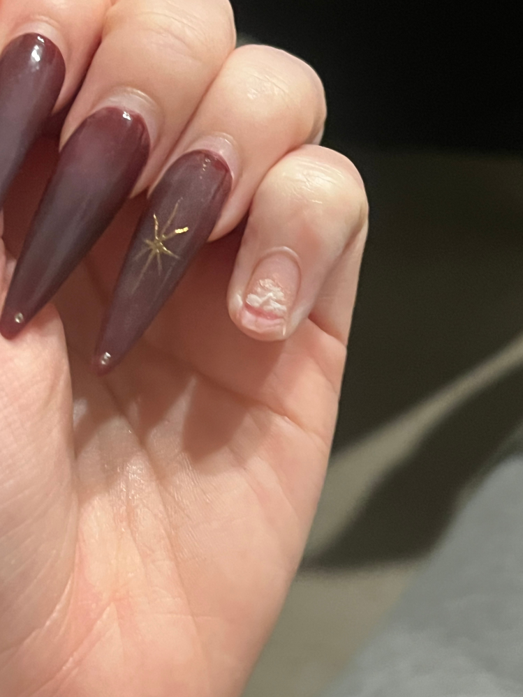 元々スカルプネイルをしてたんですが、折れてしまって自爪まで剥がれ