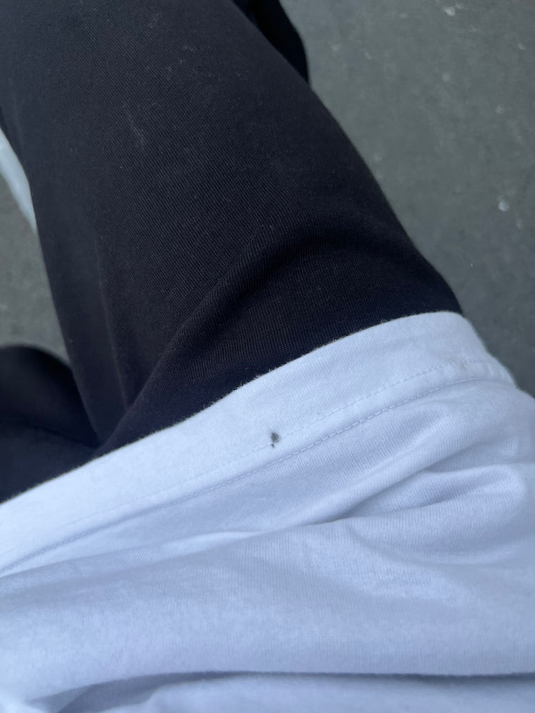 雨の日に自転車で外に出たとき、こういう黒いシミみたいなものが特にむくんでいくけど、これの原因知っている人いますか？ちなみに洗濯で落とすことはできませんでした。

j 
