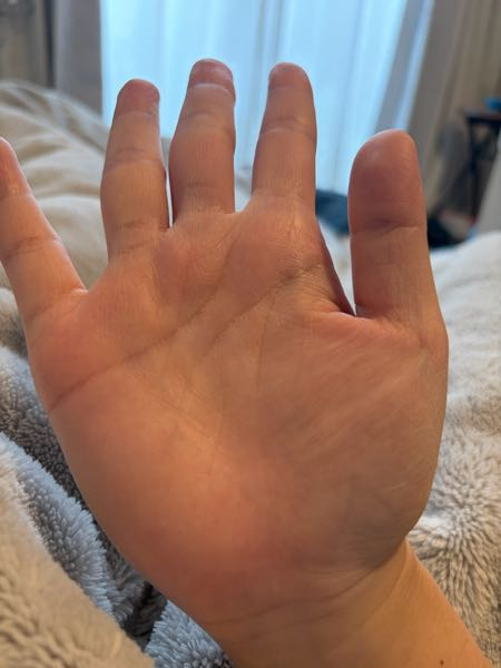 手相で病気を早期発見 ORANGE BACKS 手相を見てください22歳女です。最近人生で転機と呼ばれるフェーズが来