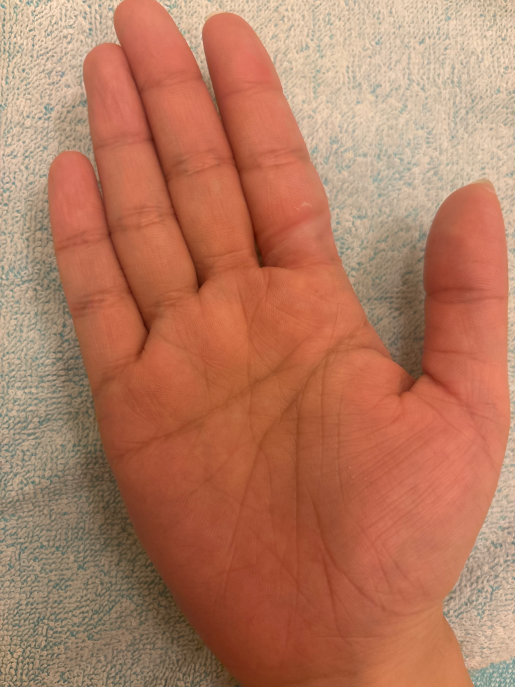 手相を見ていただきたいです。線がごちゃごちゃとたくさんあって
