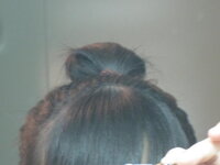 思われニキビは本当ですか アラサーです今までニキビなんてできなかった Yahoo 知恵袋