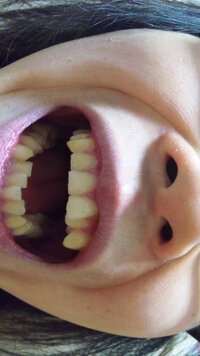 歯並びが悪いので歯列矯正をしたいのですが 今専門学生でお金が全くありません Yahoo 知恵袋