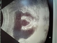 二人目妊娠16週目の妊婦です 性別が分かるそうですが先生は教えてくれない方 Yahoo 知恵袋