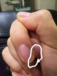 爪について私の爪は白い部分との境界線 ががたがたで綺麗じゃないです ど Yahoo 知恵袋