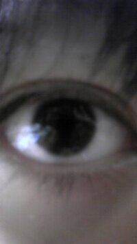 私の目は三白眼ですよね 黒目が小さいから三白眼になるのでしょうか Yahoo 知恵袋