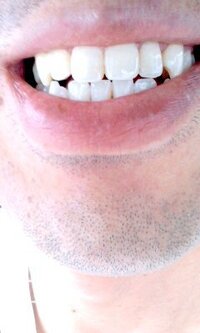 ホワイトニングしてきました 昔からヤバイ位黄色かったので Yahoo 知恵袋