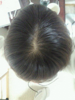 ネコっ毛の男性って、ほぼハゲる可能性高いですか？ - 髪は見た目で 