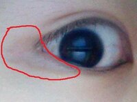 最近 目じりが切れて涙 のようなものが出て 赤くなります 若干痛い Yahoo 知恵袋