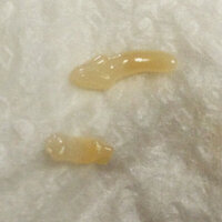 コイン250枚 寄生虫 イカを料理していたらうごめく物体が 画像 Yahoo 知恵袋