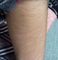 女性に質問ですこの腕の毛深さは不快に思いますか これは毛深いほうでし Yahoo 知恵袋