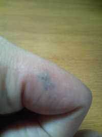 気掛かりで質問です 最近知り合った男性が手の甲の親指の付け根に3つほど刺 Yahoo 知恵袋